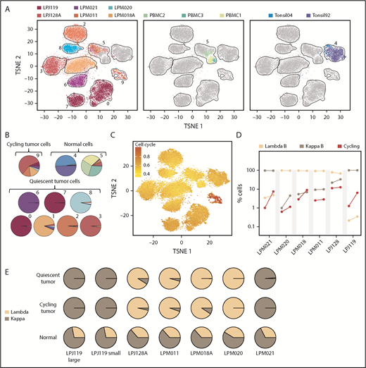 Figure 3. B cell scRNA-Seq transcriptional profiles segregate into normal and malignant phenotypes. (A) TSNE analysis of 25 106 B cells across 11 samples reveals sample-specific and shared clusters of B cells in FLs (left), PBMCs (middle), and tonsils (right). Single cells are colored according to sample origin. Shared nearest-neighbor clustering of B cells in PC space identifies 10 clusters. Normal B cells (cluster 4 and 5) were abundant in the 5 control samples and detectable in all tumor samples. Each cluster is enclosed by kernel density estimates of the coordinates of its cell members (black polygons and adjacent numbers). (B) Cluster membership and sample origin of single cells point to 3 distinct cluster phenotypes: normal, cycling and quiescent. (C) Expression of 598 genes involved in cell cycle progression (Reactome-term “Cell cycle”) was highest in cluster 9. The scale shows the GSVA enrichment score19 per cell. (D) Fraction of B-cell subsets (λ+/ κ +/ cycling), as estimated by scRNA-Seq (left) and flow cytometry (right). (E) Light chain restriction of “tumor” cluster groups in each sample show minimal contribution of nontumor cells, while the “normal” cluster group is heterogeneous.