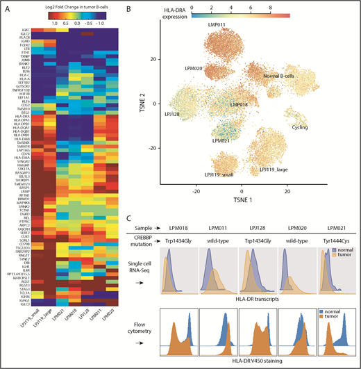 Figure 4. Differential expression analysis reveals gene transcripts recurrently enriched in either malignant or normal B cells from the same biopsy. (A) Genes with strong and recurrent patterns of enrichment are at the top and bottom of the heat map. The heat map is restricted to genes differentially expressed at ≥ 60% AUC power. (B) Overlay of class II MHC gene expression (HLA-DR) on the tSNE map shows strong differences between normal and malignant B cells for all samples, albeit in variable directions. (C) Tumor-specific expression of HLA-DR predicted from scRNA-Seq data (top) was confirmed by flow cytometry (bottom).