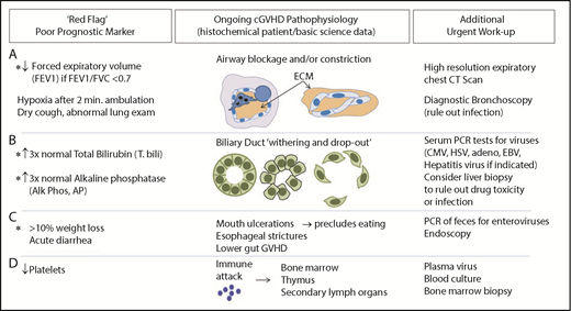 Figure 2. Assessment of worsening cGVHD reflective of cGVHD pathophysiology that requires urgent attention. (A) Decrease in FEV1 may reflect pathology of bronchiolitis obliterans found in cGVHD. High lung symptom score carries a high risk of death.102 Pulmonary function test abnormalities, specifically evidence of obstruction (FEV1/FVC <0.7) and decreases in FEV1, should raise strong suspicion for development of lung cGVHD, because FEV1 decrease without evidence of restrictive disease may reflect underlying small airway occlusion related to extracellular matrix deposited within or around the airways in cGVHD. Because a drop of FEV1 alone is an indicator of impaired lung function and could be also due to restrictive lung disease, FEV1 is a useful indicator of obstruction only when FEV1/FVC is <0.7 (consistent with obstructive lung disease). (B) Abnormal liver tests may reflect liver pathology in cGVHD that is associated with increased mortality.103 cGVHD of the liver can be diagnosed and tracked in patients using total bilirubin and alkaline phosphatase per NIH consensus criteria.25 An increase in total bilirubin occurs when conjugated bilirubin is not excreted, either because of inflammation or loss of the ducts. When the ducts are not functioning properly, alkaline phosphatase rises. Dysfunctional bile ducts can be due to bile duct dropout, presumably a result of cellular damage and preceding inflammation or (more rarely) fibrosis. Infectious or drug-induced causes, in some cases, should be ruled out via biopsy. (C) Significant weight loss with or without diarrhea warrants further investigation because of its association with increased mortality.94,104 The etiology of weight loss may be multifactorial and, importantly, may be reversible (eg, decreased calorie intake related to oral cGVHD, esophageal stricture, or intestinal malabsorption). (D) Abnormalities found on the complete blood count are known prognostic factors,9,79,101,105 including in newly diagnosed cGVHD.81,105 CMV, cytomegalovirus; EBV, Epstein-Barr virus; HSV, herpes simplex virus; PCR, polymerase chain reaction.