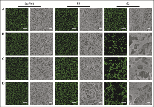 Figure 3. The effect of Affimers F5 and G2 on fibrin network structure. Scaffold and Affimer proteins F5 and G2 were added to plasma clots and visualized using laser scanning confocal microscopy and scanning electron microscopy. For confocal images, clots were made with the addition of fluorescently labeled Alexa Fluor-488 fibrinogen. Z stacks of 30 slices over 20.30 µm were taken, 3-dimensional images of compiled Z stacks are presented. Clots were made with increasing concentrations of Affimer proteins (increasing Affimer:fibrinogen molar ratio). (A) Buffer-only control, (B) 1:1, (C) 5:1, and (D) 10:1 Affimer:fibrinogen molar ratio. Laser scanning confocal microscopy scale bar = 20 μm; scanning electron microscopy scale bar = 1 μm.