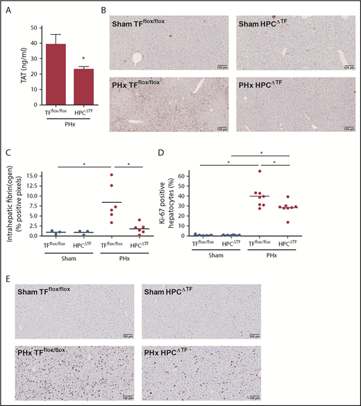 Figure 1. Effect of liver TF deficiency on coagulation activation, fibrin(ogen) deposition, and liver regeneration after PHx. TFflox/flox mice and TFflox/flox/albumin Cre (HPCΔTF) mice were euthanized 30 minutes (n = 3 for sham, n = 6 for PHx) or 3 days (n = 6 for sham, n = 8 for PHx) after sham or PHx. (A) TAT plasma levels 30 minutes after PHx for TFflox/flox mice and HPCΔTF mice. (B) Representative images of fibrin(ogen) immunohistochemical staining 30 minutes after sham (upper panels) or PHx (lower panels). (C) Quantification of fibrin(ogen) deposition in TFflox/flox and HPCΔTF mice, expressed as percent positive pixel count. (D) Quantification of Ki-67–positive hepatocytes, expressed as the percentage of the total number of hepatocytes. (E) Representative images of Ki-67–stained livers for sham (upper panels) or PHx (lower panels) 3 days after surgery. Bars represent mean + SEM. Horizontal lines represent the mean, closed circles are individual mice. *P < .05.