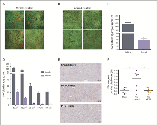 Figure 3. Coagulation–platelet cross talk during liver regeneration after PHx. Platelets were visualized in the liver remnant using intravital microscopy. Platelets were labeled by IV injection of phycoerythrin-conjugated anti-mouse CD49b (red) immediately after PHx. Imaging was performed for 1 hour. Autofluorescent signal of the liver is shown in green to visualize liver anatomy. Representative images at 30 minutes after PHx in (A) vehicle-treated mice (n = 4) and (B) ancrod-treated mice (n = 4); images are from 4 individual mice per treatment group. Original magnification, 100×. Quantification of: (C) the number of platelet aggregates per field of view (FOV) and (D) the size equal to or larger than the indicated sizes. (E) Representative images of fibrin(ogen)-stained livers 30 minutes after sham (upper left panel) or PHx (upper right panel) for control mice, and 30 minutes after PHx for mice receiving R300 to deplete platelets (lower left panel). (F) Quantification of fibrin(ogen) deposition, expressed as percentage of positive pixel count, in livers of vehicle-treated mice (n = 7) or mice receiving R300 (n = 8) to deplete platelets. (F) Data are expressed as mean + SEM. *P < .05.