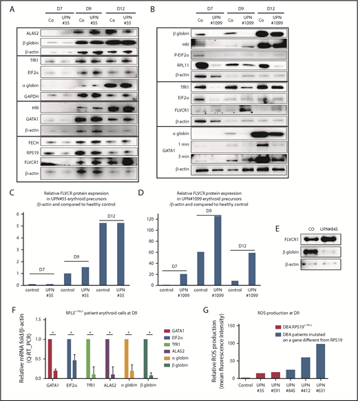 Figure 3. DBA-affected patients also exhibit excess free heme. (A) Expression levels of the major proteins involved in heme metabolism and their regulators in a DBA patient who carried a mutation in the RPS19 gene during terminal erythroid differentiation compared with a healthy control. Immunoblots of 50 000 human primary erythroid cells in each lane obtained from purified peripheral blood CD34+ cells from the affected DBA patient (UPN#35) during terminal erythroid differentiation from day 7 (D7) to day 12 (D12). Protein expression compared with β-actin or GAPDH, depending on the size of the proteins, to optimize the numbers of proteins analyzed on the same western blot. Due the difficulty in obtaining samples from DBA patients, this patient has been studied once; other DBA-affected patients have been studied. We validated the data because the same protein profile on the western blots in all of the mutated RPS19 DBA patients have been seen (as example another mutated RPS19Mut/+ patient, supplemental Figure 5). (B) Same data as in (A) for a DBA-affected patient who carried a mutation in the RPL11 gene (UPN#1099). (C) From the immunoblot in panel A, representation of the level of protein expression of FLVCR1 in the erythroid precursors of DBA patient UPN#35 relative to β-actin and in a healthy control at each day of the studied terminal erythroid differentiation. (D) From the immunoblot in panel B, representation of the level of FLVCR1 expression in the erythroid precursors of DBA patient UPN#1099 relative to β-actin and to the healthy control during terminal erythroid differentiation (value = 1 at day 7 in the control erythroid cells). (E) Increased FLVCR1 and decreased globin expression levels in a DBA-affected patient with a mutated RPL5 gene (RPL5Mut/+) (UPN#845). (F) Relative mRNA expression of GATA1, ALAS2, EIF2α, α and β globins, and TfR1 in a DBA-affected patient (UPN#845) compared with a healthy control (value = 1). (G) Relative ROS production by various DBA-affected patients. These DBA patients carried mutations in the RPS19 or RPL5 gene or even an unknown gene compared with their healthy controls (mean fluorescence intensity = 1). *P < .05 in triplicate experiments.
