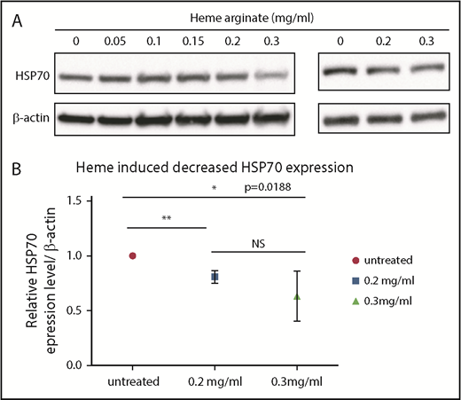 Figure 5. Heme induced a decrease in HSP70 expression. (A) Immunoblots performed using lysates of UT7 cells (left panel) or day-2 CD36+ human primary erythroid cells (right panel) that were treated for 4 hours with the indicated concentrations of heme arginate. (B) Immunoblot quantification. Values are quantified relative to actin and normalized to untreated cells. The mean ± standard deviation of 4 experiments are shown. *P < .05, **P < .01, unpaired Student t test.