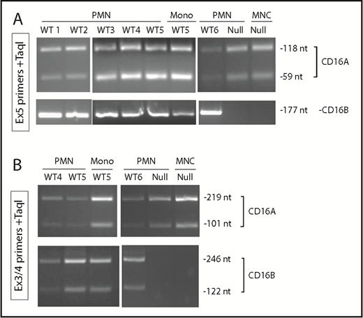 Figure 5. Highly purified PMNs express FCGR3A messenger RNA. PMNs from 6 FcγRIIIB WT donors (WT1-6), as well as the FcγRIIIB-null donor (Null), were purified to >99%. Peripheral blood MNCs or CD14+ purified monocytes (Mono) were used as controls. RNA was extracted, and RT-PCR was performed using FCGR3A- or FCGR3B-specific primers, corresponding to exon 5 (A) or exon 3 to 4 (B) sequences. PCR products were cut with TaqI restriction enzyme to distinguish the 2 genes and run on a 4% agarose gel. The expected products for FCGR3A or FCGR3B are shown on the right.