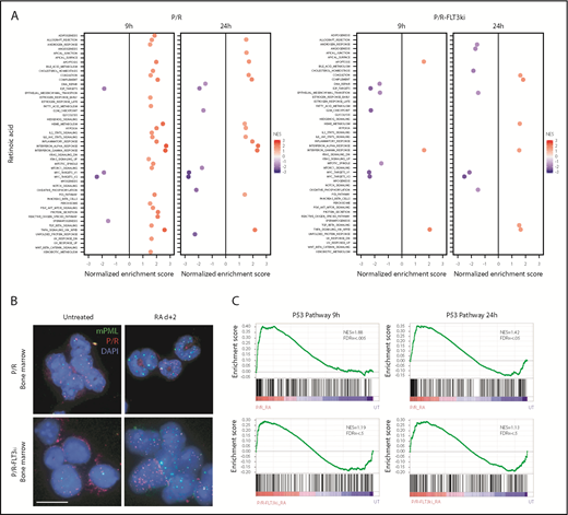 Figure 3. Transcriptional analysis and PML NB reformation on ATRA treatment. (A) GSEA analysis for 50 hallmark gene sets in P/R and P/R-FLT3ki mice treated or not during 9 or 24 hours with ATRA. Only significant pathways were represented (with FDR.q.val <0.05) according to NES value. (B) PML NB reformation assessed by immunofluorescence analysis of mPML (green) and human PML/RARA (red) with DAPI (blue) in bone marrow cells of P/R and P/R-FLT3ki APL mice treated with ATRA after 2 days (scale bar, 10 µm). (C) GSEA analysis of the p53 pathway in P/R and P/R-FLT3ki mice treated during 9 or 24 hours with ATRA. NES and FDR are noted. FDR.q.val <0.05 are in bold.