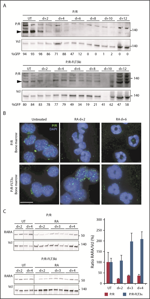 Figure 4. Effect of FLT3-ITD on PML/RARA degradation on ATRA treatment. (A) Western blots of hPML/RARA (P/R, arrowheaded) and vinculin (Vcl) expression in the bone marrow of P/R (top) and P/R-FLT3ki (bottom) APL untreated (UT) and ATRA-treated mice from 2 to 12 days. Antihuman PML antibody. The percentage of GFP-positive cells is indicated for each sample. (B) Immunofluorescence analysis of human PML/RARA (green, P/R) with DAPI (blue) in bone marrow cells of P/R and P/R-FLT3ki APL mice treated with ATRA after 2 and 6 days (scale bar, 10 µm). (C) Western blot analysis of RARA degradation on in vivo ATRA treatment of the indicated time in both APL models (left). Graph shows quantification of RARA/Vcl ratio, indicative of RARA degradation (right).