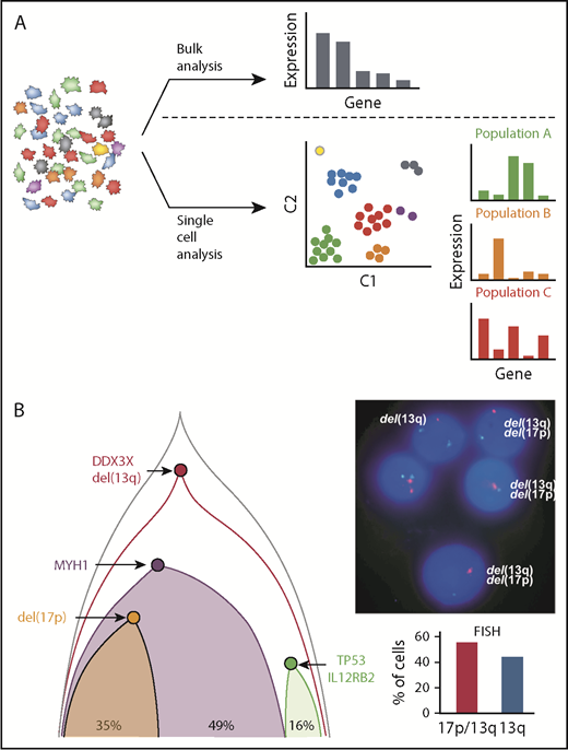 Figure 3. Novel insights into CLL based on single-cell analysis. (A) Bulk analysis of heterogeneous tumor samples, including those admixed with immune and stromal cells, provides useful global gene expression data but results in loss of granularity. Single-cell approaches allow analysis within individual cells as well as in similar cell populations that have clustered to identify unique signatures, cellular processes, networks, and rare cell populations, which provides higher resolution biological insights. (B) Single-cell mutational analysis can yield detailed phylogenetic trees to identify which mutations occur in specific unique subclones and which track together. In this example, multiple sCNA and sSNV were interrogated by using targeted sequencing to establish the underlying clonal architecture of the leukemia. This demonstrated convergent loss of TP53 with 17p deletion in 1 subclone and TP53 mutation in another, which was further corroborated by conventional FISH analysis by Wang et al.50