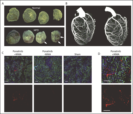 Figure 4. Coronary artery and LV coronary microvascular anatomy. (A) Ex vivo epifluorescent illumination of microspheres in sequential ventricular short-axis sections illustrating normal perfusion, and focal regions of myocardial perfusion defect (MPD) (arrows). (B) CT coronary angiography in the left lateral projection illustrating lack of arterial occlusion in 2 ponatinib-treated mice with WMAs. (C) Fluorescent confocal microscopy of the LV myocardium from ponatinib-treated wild-type mice showing regions with and without WMAs and from a sham-treated mouse. Staining was performed with isolectin (green) for microvessels, Hoechst stain for nuclei (blue), and platelet CD41 immunohistochemistry (red). The bottom rows illustrate the red channel alone to better display platelets. Scale bars, 100 μm. (D) Higher-magnification image from the ponatinib-treated animal with WMA.