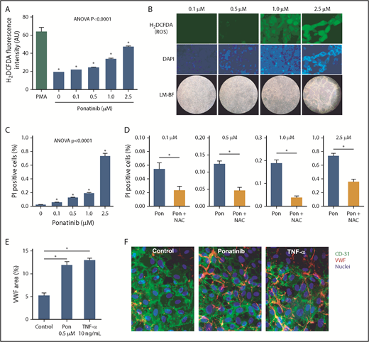 Figure 6. Dose-dependent effects of ponatinib on endothelial cell ROS production and viability. (A) ROS generation by SVEC4-10 endothelial cells in culture measured by mean (± SEM) H2DCFDA fluorescence after 24 hours of ponatinib treatment. Positive control data are shown for phorbol 12-myristate 13-acetate (PMA)–treated cells. (B) Examples of SVEC4-10 cells exposed for 24 hours to ponatinib (0.1 to 2.5 μM) by fluorescent imaging of H2DCFDA and DAPI (nuclear staining) illustrating dose-dependent increase in ROS, and low-magnification bright-field (LM-BF) microscopy illustrating loss of cell confluence at high concentrations. (C) Mean (± SEM) cell viability after 24 hours of exposure to ponatinib (0.1 to 2.5 μM) determined by the proportion of cells staining positive for PI. *P < .05 vs all other conditions by post hoc testing after correction for multiple comparisons. (D) Cell viability at various concentrations of ponatinib (Pon) with and without NAC. *P < .05. (E-F) Mean (± SEM) area for externalized VWF on HUVECs in a microfluidic chamber after 24 hours of exposure to ponatinib (0.5 μM), TNF-α (10 ng/mL), or control serum, and examples of fluorescent microscopy for each condition. *P < .01. AU, arbitrary unit.