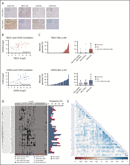 Figure 4. Unsupervised HC of CNAs in PTCL. (A) IHC staining of GATA3, TBX21, CCR4, and CXCR3 in a molecularly classified case of PTCL-TBX21 (upper panels) or PTCL-GATA3 (lower panels). Original magnification of ×200 with an inset magnification of ×400. (B) Positive correlation of TBX21 and CXCR3 mRNA expression in the PTCL-TBX21 subgroup (upper panel) and GATA3 and CCR4 mRNA expression in the PTCL-GATA3 subgroup (lower panel). (C) Histograms (left panels) and boxplots (right panels) of the percent aberrant genome of PTCL-GATA3 and PTCL-TBX21 molecularly classified cases, along with PTCL-GATA3–like and PTCL-TBX21–like cases, from 2 published series.22,23 (D) Unsupervised HC of 3 PTCL-NOS series22,23 by recurrent CNAs observed in the PTCL-GATA3 or PTCL-TBX21 molecular subgroups at a frequency ≥10%. The molecular PTCL-GATA3/GATA3–like cases (blue shades) dominate the central clusters, whereas the outside clusters, which tend to lack frequent CNAs, are predominately molecular PTCL-TBX21/TBX21–like cases (red shades). The frequency of these aberrations in the molecularly classified PTCL-NOS subgroups from the present study are depicted to the right of the cluster. (E) Matrix of Pearson correlation coefficients for co-occurring CNAs. Abnormalities depicted in blue type are more frequent in PTCL-GATA3, whereas abnormalities depicted in red type are more frequent in PTCL-TBX21. The black type (6p-Gain) represents a CNA that was observed at near-equal frequencies in the 2 molecular subgroups.
