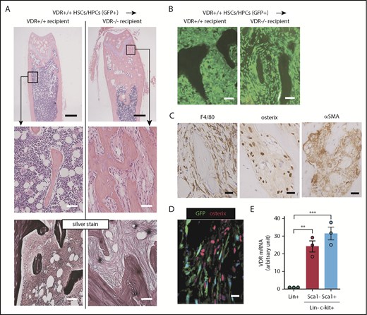 Figure 3. Marrow fibrotic tissue is composed of 2 distinct populations with identical morphology. (A-B) Femur sections of VDR+/+ and VDR−/− recipient mice transplanted with VDR+/+GFP+CD45+lineage−c-kit+ BM cells (2 months after transplantation): (A) H&E and silver staining and (B) GFP fluorescence. Scale bars, 500 μm (black) and 50 μm (white). (C-D) Immunohistochemical staining of F4/80, osterix, and α-SMA (C) and GFP expression and immunofluorescence staining of osterix (D) in marrow fibrotic tissue of VDR−/− recipient. Scale bars, 20 μm (black) and 20 μm (white). (E) VDR mRNA expression in lineage-positive (Lin+), Lin−c-kit+Sca1−, and Lin−c-kit+Sca1+ fractions from VDR+/+ BM (n = 3). Representative pictures or combined data of at least 3 independent experiments are shown. Data are represented as mean plus or minus SEM. **P < .01, ***P < .001 (ANOVA).