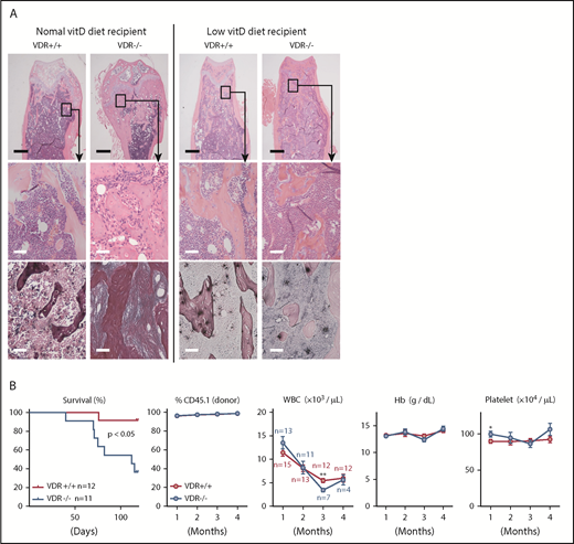 Figure 4. Low vitamin D diet prevents myelofibrosis and osteosclerosis in the basic model. (A) H&E and silver staining in femur sections of VDR+/+ and VDR−/− recipient mice transplanted with VDR+/+ BM (1 month after transplantation). Recipient mice were fed with a normal or low vitamin D diet after weaning, and transplanted at 7 to 8 weeks old. Scale bars, 500 μm (black) and 50 μm (white). (B) Survival, donor chimerism, and blood cell counts in VDR+/+ and VDR−/− recipient mice (low vitamin D diet) transplanted with VDR+/+ BM. Combined data of at least 3 independent experiments are shown. Data are represented as mean plus or minus SEM. *P < .05, **P < .01 (Kaplan-Meier analysis and Student t test).