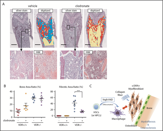 Figure 5. Depletion of macrophages prevents myelofibrosis in the basic model. (A-B) Silver and H&E staining in femur sections of VDR−/− recipient mice transplanted with VDR+/+ BM that were treated with clodronate liposome (1 month after transplantation). Silver staining of the metaphysis was digitized to distinguish fibrosis (blue), trabecular bone (red), and hematopoietic area (yellow; A) and enumerated as the ratio of each area (B; n = 6-8). Scale bars, 500 μm (black) and 50 μm (white). (C) Proposed concept of the basic model. Differentiation of immature hematopoietic cells is skewed toward macrophages, which likely drives myofibroblasts (and also osteoblasts presumably) as collagen producers, leading to myelofibrosis and osteosclerosis. Morphological marrow fibroblasts are composed of both macrophages and myofibroblasts. Representative pictures or combined data of at least 3 independent experiments are shown. Data are represented as mean plus or minus SEM. ***P < .001 (ANOVA).