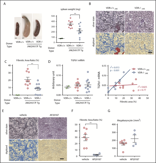 Figure 7. VDR signaling and macrophages are therapeutic targets for JAK2V617F-driven myelofibrosis. (A-D) WT mice were transplanted with BM from WT (VDR+/+), VDR+/+/JAK2V617F Tg (VDR+/+JAK), or VDR−/−/JAK2V617F Tg (VDR−/−JAK) mice (n = 2, 9, and 10, respectively). Three months after transplantation, the appearance and size of the spleen (A; scale bars, 2 mm), silver staining of femur sections with enumeration of digitized pictures (B-C; scale bar, 50 μm), and the correlation between the severity of fibrosis and TGF-β1 mRNA expression in the bone tissue including BM (normalized to β-actin; D) were assessed. (E-G) WT mice transplanted with BM from JAK2V617F/MaFIA double Tg mice were treated with AP20187 to deplete macrophages. Three months after transplantation, silver staining of femur sections with enumeration of digitized pictures (E-F) and megakaryocyte numbers (G) were assessed (n = 4-7). Scale bar, 50 μm. Representative pictures or combined data of at least 3 independent experiments are shown. Data are represented as mean plus or minus SEM. **P < .01 (Student t test and Pearson correlation coefficient).