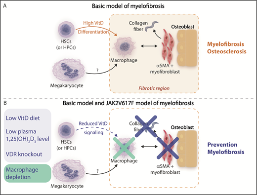 (A) Basic model of myelofibrosis. Increased vitamin D (VitD) signaling resulting from high circulating 1,25(OH)2 vitamin D3 levels acting on transplanted VDR+/+ hematopoietic stem cells (HSCs) and hematopoietic progenitor cells (HPCs) facilitates bone marrow macrophage differentiation. Bone marrow macrophages are proposed to be critical mediators of the development of bone marrow fibrosis acting in concert with other cells observed in fibrotic areas such as osterix+ α-smooth muscle actin–positive (osterix+αSMA+) myofibroblasts and osteoblasts and potentially downstream of megakaryocytes, which were not observed in regions of fibrosis. (B) Mitigation of myelofibrosis in the basic and JAK2V617F transplantation models of myelofibrosis. Reducing VitD signaling by reducing circulating 1,25(OH)2 vitamin D3 levels using a diet low in vitamin D or genetic deletion of the VitD receptor (blue panel) or direct depletion of macrophages (green panel) prevents the development of myelofibrosis in the basic model and a JAK2V617F transplantation model of myelofibrosis. Professional illustration by Somersault18:24. This figure is based on Figure 5C in the article by Wakahashi that begins on page 1619.