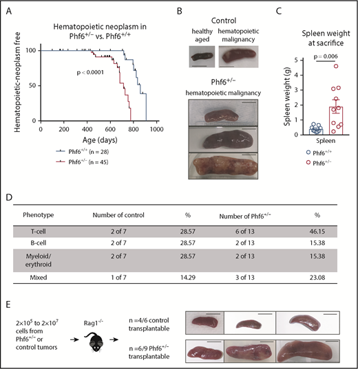 Figure 1. Development of leukemia in mice with targeted Phf6 deletion. (A) Kaplan-Meier survival curve showing deaths due to hematopoietic neoplasm in Phf6+/− mice vs Phf6+/+ control mice. Note, a proportion (42% in the female cohort described here) of aged wild-type C57BL/6 mice develop spontaneous hematopoietic neoplasms. A vertical dash on the survival curve indicates deaths due to other causes. Data were analyzed using the Gehan–Breslow–Wilcoxon test. (B) Representative disease-free wild-type control spleen and spleens from Phf6+/+ control mice and Phf6+/− mice with hematopoietic malignancy. (C) Spleen weight of Phf6+/− mice (n = 10) compared with sick Phf6+/+ mice (n = 9), both with hematopoietic malignancy. Data were analyzed using the 2-tailed Student t test and are displayed as individual data points with mean ± standard error of the mean (SEM). (D) Table showing immunophenotype of Phf6+/− and control tumors. There was no significant effect of Phf6 heterozygous mutation. Data were analyzed using the χ2 test. (E) Outcome of transplantation of malignant splenocytes from Phf6+/− and Phf6+/+ mice and photographs of spleens from Rag1−/− recipient mice. Scale bars, 1 cm.