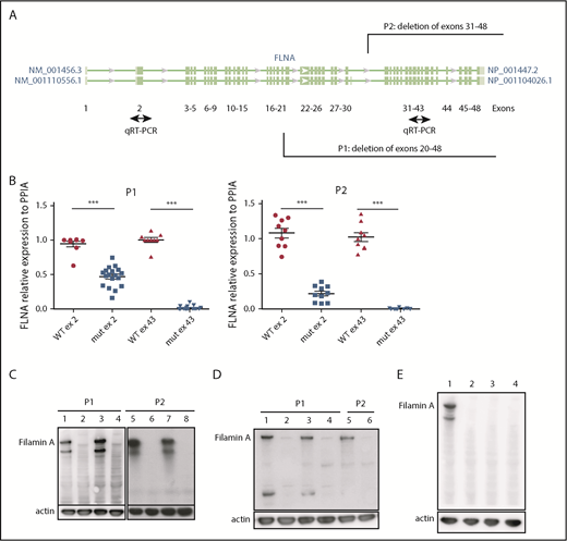 Figure 1. Patient iPSCs display unstable FLNA mRNA and no FLNa. (A) Quantitative reverse transcription polymerase chain reaction (qRT-PCR) primer design for the identification of the expressed X chromosome. Amplification of exon 2 allows detection of both WT and mutated messenger RNA (mRNA); that of exon 43 allows detection of only the WT mRNA. (B) qRT-PCR for FLNa expression on 2 different exons for several iPSC clones (9 FLNAWT and 20 FLNAmut clones for P1; 9 FLNAWT and 10 FLNAmut clones for P2). Results are presented as mean ± standard error of the mean; unpaired Student t test with Welch’s correction was used; each point represents 1 independent experiment. (C-D) Representative immunoblots for FLNa expression on 4 iPSC clones for each patient using a C-terminus–specific antibody (C) and a N-terminal antibody (D). Lines 1, 3, 5, and 7 represent FLNAWT clones, and lines 2, 4, 6, and 8 represent FLNAmut clones. (E) Immunoblot for FLNa expression on iPSCs cultivated for 60 passages using C-terminal antibody. Line 1 represents FLNAWT clone, and lines 2 to 4 represent 3 different FLNAmut clones. ***P < .001.