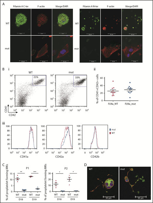 Figure 2. FLNa deficiency induces a marked defect in proplatelet formation. (A) Immunofluorescence staining for the expression of FLNa (green), F-actin (red), and nucleus (blue) in iPSC-derived MKs from P1; scale bar = 30 μm. (B) Flow cytometry analysis of CD41a, CD42a, and CD42b expression: representative dot plot (i) and relative percentages (ii) (n = 10); histogram representative of mean fluorescence intensity for CD41a and CD42a (n = 5) and for CD42b (n = 3); paired Student t test (iii). (C) Proplatelet formation potential of patient iPSC-derived clones. At least 2 clones were assayed for each genotype, for each patient, at 2 different time points. Results are presented as mean ± standard error of the mean; unpaired Student t test with Welch’s correction was used; each point represents 1 independent experiment. (A-B) Experiments were performed at day 15 or 16 of MK differentiation. (C) Proplatelet formation was measured at days 18 and 19. (D) Representative pictures for WT and mutant proplatelet-forming MKs from P1. Immunofluorescence staining of F-actin (green) and β-tubulin (red) was performed after adhesion on fibrinogen for 24 hours. The nucleus is stained with 4′,6-diamidino-2-phenylindole (DAPI; blue); scale bar = 30 μm. *P < .05, **P < .01, ***P < .001.