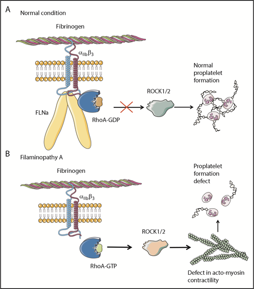 Figure 6. Pathological mechanism for FLNa-deficient MKs. (A) In the presence of FLNa, the interaction between fibrinogen and its receptor αIIbβ3 does not trigger RhoA pathway activation. No anomalies in proplatelet formation could be observed. (B) In the absence of FLNa, the interaction between fibrinogen and αIIbβ3 leads to an increase in RhoA activity. Consequently, the normal actomyosin contractility is disrupted via ROCK1/2 activity, and this leads to deeply flawed proplatelet formation. This increased RhoA activity in the absence of FLNa is specifically dependent on fibrinogen and absent in the presence of other extracellular matrices like fibronectin, vitronectin, collagen 1, or VWF.