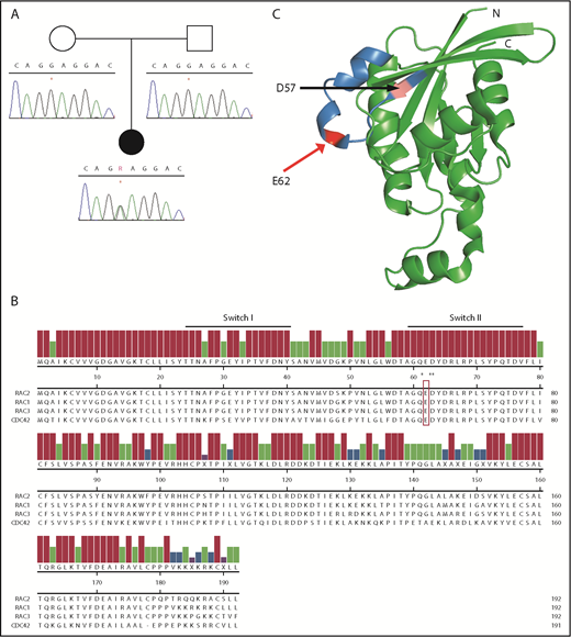 Figure 1. RAC2 mutation occurs within the highly conserved Switch II domain. (A) Sanger sequence of RAC2 exon 3 demonstrating c.184G>A in patient 1 (*) and wild-type sequence in both parents. (B) Amino acid alignment of select members of human RHO family of GTPases. Reference sequences (RAC2 NP_002863.1, RAC1 NP_008839.2, RAC3 NP_005043.1, CDC42 NP_001782.1) are from the National Center for Biotechnology Information and aligned using Clustal W. Underline, conserved Switch I and Switch II regions; open box, E62; *Q61, D63, and Y64. (C) Three-dimensional structure of the related RAC1 (3TH5)46; blue, Switch II; pink, D57 residue; and red, E62. C, C terminus; N, N terminus.
