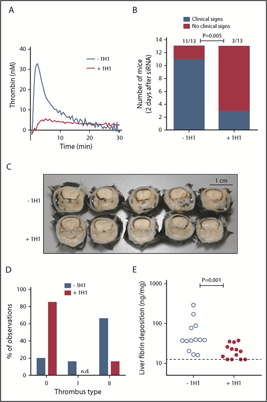 Figure 1. TF-induced coagulation is rate-limiting for VT that follows inhibition of antithrombin and protein C. (A) Thrombin generation initiated by TF-positive cell extract (mouse smooth muscle cells). In a parallel group of mice (n = 3), control antibody or 1H1 was injected intraperitoneal (no siRNA treatment). Forty-one hours after antibody treatment, mice were euthanized, and citrated blood was collected via the vena cava. Platelet-poor plasma was used for thrombin generation analysis. Curves represent the average of 3 mice treated with either control antibody (–1H1) or 1H1 antibody (+1H1). (B) Clinical phenotype in mice treated with siRNAs targeting Serpinc1 and Proc, treated with control antibody or 1H1. Mice exhibiting characteristic clinical signs (blue bars) and mice unaffected (red bars) 2 days after siRNA treatment (end of experiment). P = .001, Fisher’s exact test. Of note, results from experiment 1 (–1H1: 3 of 3 mice affected vs +1H1: 1 of 3 mice affected) and experiment 2 (–1H1: 8 of 10 mice affected vs +1H1: 2 of 10 mice affected; P = .02) were pooled. (C) Representative cross-sections of the whole head of mice (formalin-fixed and decalcified) from the –1H1 and the +1H1 groups (n = 5). Cross-sections were taken behind the eye and show the presence of macroscopically visible coagulopathy in and around the mandibular area (white asterisks). In this area, coagulopathy was visible for 11 of 13 −1H1 mice and 3 of 13 +1H1 mice. All mice were treated with siSerpinc1/siProc. The black bar represents 1 cm. (D) Descriptive scoring for the type of detected thrombi. 0: no thrombi found; I + II: thrombi categories were based on structure and layering (see Methods section and supplemental Figure 4). Blue bars: −1H1 (n = 26); red bars: +1H1 (n = 26). Of note, results from experiment 1 (n = 6) and experiment 2 (n = 20) were pooled. (E) Levels of fibrin deposition in the liver in −1H1 (open circles) and +1H1 (filled circles) mice. P = .001. Of note, for the second 1H1 experiment (n = 10) liver fibrin deposition: −1H1: 37.4 ng/mg (16.1, 289.8) and +1H1: 15.6 ng/mg (12.5, 25.9); P = .003. Mann-Whitney rank sum test. Dashed line indicates the detection limit of 12.5 ng/mg. Fibrin deposition levels for C57BL/6J female mice (n = 6), treated with 1H1 or control antibody only, were below the detection limit (<12.5 ng/mg).