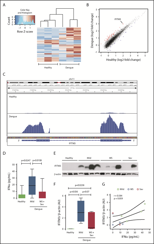 Figure 1. The human platelet transcriptome is altered during dengue infection. Platelets were isolated from patients with confirmed dengue infection or matched healthy control subjects. Purified platelets were isolated as described in “Methods.” (A) Heat map of significantly differentially expressed (adjusted P < .05) transcripts in dengue-infected patients (n = 3) and healthy control subjects (n = 3). Red indicates significantly enriched transcripts, and blue indicates significantly repressed transcripts. (B) Scatter plot with significantly enriched (red) and repressed (blue) transcripts. IFITM3 is indicated (enlarged dot). (C) Representative Integrative Genomics Viewer browser image of IFITM3 mRNA expression in a dengue-infected patient (bottom) or healthy control subject (top). The vertical axis represents the relative amount of mRNA, and the horizontal axis shows the introns (thin lines) and exons (thick lines). (D-G) Whole blood samples were drawn from patients with mild dengue infection (mild, n = 4), dengue-infected patients with warning signs (WS) or severe infection (Sev) (WS + Sev, n = 7), or healthy matched control subjects (n = 3). (D) Plasma levels of IFNα in healthy subjects (healthy) and in patients with mild dengue infection or severe dengue with WS. (E-F) Immunoblot and densitometric quantification of IFITM3 and β-actin expression in platelets isolated from healthy subjects (n = 3) and dengue-infected patients (n = 11) with mild, WS, or severe infection. The immunoblot results shown from healthy control subjects are representative of >30 individuals. (G) Plasma IFNα levels were plotted against IFITM3 protein expression in platelets from patients with dengue. Linear regression (± 95% confidence interval) was traced according to the distribution of the dots.