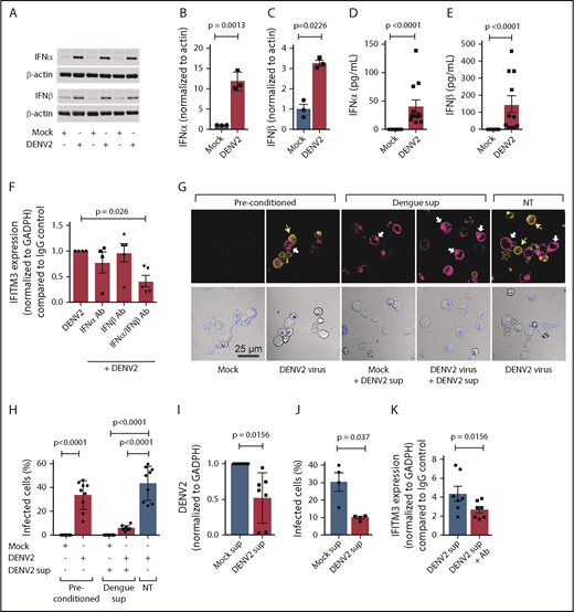 Figure 6. MKs exposed to dengue release type I IFNs to induce IFITM3 and limit viral infection. (A-E) CD34+-derived human MKs were infected with DENV2 (MOI 1.0; culture day 12; t = 18 hours) or mock control. (A-C) Type I IFN (IFNα and IFNβ) protein expression was measured according to immunoblot in MK cell lysates and quantified according to densitometry. Immunoblots show n = 3 independent biological replicates. (D-E) Supernatants from MKs infected with DENV2 were also measured for IFNα and IFNβ by using an enzyme-linked immunosorbent assay (n = 10-11). (F) MKs were infected with DENV2 in the presence of blocking antibodies specifically against IFNα (1 μg/mL), IFNβ (1 μg/mL), or both or immunoglobulin G (IgG) controls. IFITM3 mRNA expression in MKs was measured by using quantitative RT-PCR (qRT-PCR) (n = 4-5). (G) MKs were preconditioned with DENV2 (MOI 0.1) or mock virus control (mock) on culture day 10 (t = 18 hours). After 18 hours, supernatants were harvested from DENV2 or mock preconditioned MKs. Freshly cultured MKs were then treated with harvested supernatants from DENV2 preconditioned MKs (+DENV2 sup) or left alone (NT), and infected with DENV (DENV2 virus, MOI 1.0) or mock control (Mock). After 18 hours, dengue infection in MKs was determined by using immunocytochemistry with an antibody against DENV2 (orange, top row). In parallel, IFITM3 protein expression was examined (magenta, top row). Nuclei were stained by using TO-PRO-3 (blue) and shown in the bottom panels depicting the transmission channel. The white arrows point to IFITM3-positive cell bodies, and the yellow arrows highlight cells that stained positive for DENV2. Scale bars = 25 µm. (H) Images were quantified by using CellProfiler as described in “Methods.” The bar graph shows the percentage of DENV2-infected MKs. (I-J) Human HSCs were pretreated with harvested supernatants from mock (Mock sup) or dengue (DENV2 sup) infected MKs, under conditions described in (E). (I) DENV2 mRNA was measured by using qRT-PCR, and (J) the number of dengue-infected HSCs were quantified by microscopy. (K) HSCs were infected with DENV2 in the presence of blocking antibodies specifically against IFNα or IFNβ or both or IgG controls. IFITM3 mRNA expression in MKs was measured by using qRT-PCR (n = 7).