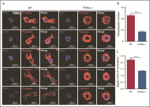 Figure 2. Formation of chemoattractant-induced pseudopodia in WT and PTENα−/− neutrophils. (A) Visualization of formation of pseudopodia and changes in cellular morphology in isolated neutrophils after fMLP stimulation. Cells were stained with phalloidin (F-actin stain) and DAPI (nuclear stain). The images were acquired using a Nikon TCS A1 confocal microscope (100× lens objective). (B) The numbers of WT and PTENα−/− neutrophil pseudopodia (n = 50) were counted after fMLP stimulation. (C) Analysis of the aspect ratio (ratio of the longest axis to the shortest perpendicular axis) of WT and PTENα−/− neutrophils (n = 50) after fMLP stimulation. Data are mean ± standard error of the mean. ****P < .0001, 2-tailed unpaired Student t test.