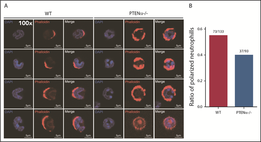 Figure 3. Polarization is decreased in stimulated PTENα−/− neutrophils. (A) Increased numbers of WT neutrophils showed visible polarization after MIP-2 stimulation. Cells were stained with phalloidin (F-actin stain) and DAPI (nuclear stain). The images acquired using a Nikon TCS A1 confocal microscope (100× lens objective). (B) The percentages of polarized WT (n = 133) and PTENα−/− (n = 93) neutrophils (F-actin localizing at the leading edge of the cell) were recorded after MIP-2 stimulation.