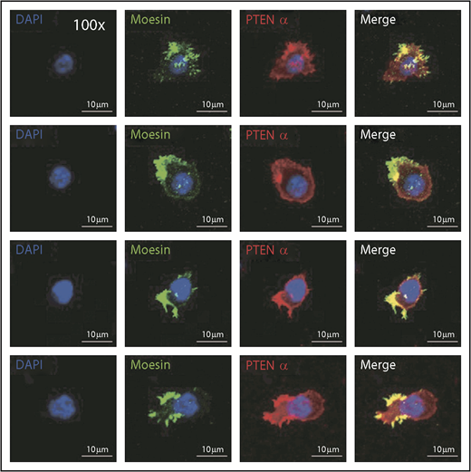 Figure 4. PTENα colocalizes with moesin at the apical domain of pseudopodia in neutrophils. Harvested cells were stained with anti-PTENα antibody, anti-moesin antibody, and DAPI (nuclear stain). The images were acquired as 3-channel images using a Nikon TCS A1 confocal microscope (100× lens objective).