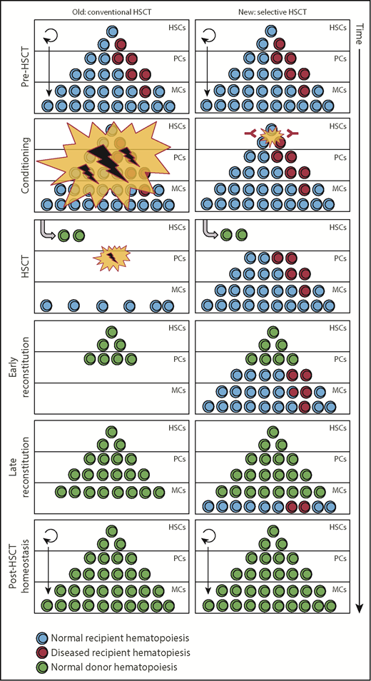 Key differences between conventional (left) and selective immune-mediated (right) conditioning for HSCT. Conventional HSCT conditioning regimens target most hematopoietic cells, including healthy and malignant HS(P)C, and generate nonhematopoietic environmental damage, leading to temporary pancytopenia and nonhematopoietic toxicity. Selective conditioning specifically eliminates HS(P)C (and their diseased counterparts) and subsequent HSCT leads to seamless blood production without nonhematopoietic damage. PCs, progenitor cells; MCs, mature cells.
