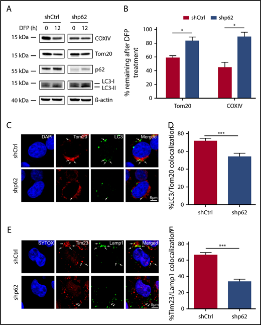 Figure 5. Impaired mitophagy in leukemia cells after loss of p62. (A) shCtrl and shp62 MN1-driven ldMBM leukemia cells were treated for 12 hours with 1 mM DFP. Lysates were analyzed by western blotting for the inner mitochondrial protein COXIV and the outer mitochondrial protein Tom20 and the autophagic markers p62 and LC3. β-Actin served as a loading control. (B) Quantification of remaining protein expression after 12 hours of treatment with DFP of mitochondrial proteins Tom20 and COXIV compared with 0 hours using density analysis of western blots (n = 3 independent experiments). (C) Immunofluorescent staining of shCtrl and shp62 MN1-driven ldMBM leukemia cells after 12 hours of treatment with 1 mM DFP was performed with the mitochondrial and autophagic markers Tom20 and LC3, respectively. Arrows indicate colocalization of both markers. Tom20 and LC3 were immunostained with fluorescent dyes Alexa Fluor 647 and Alexa Fluor 593, respectively. DAPI (4′,6-diamidino-2-phenylindole) was used as a nuclear stain. Scale bar = 5 µm. Original magnification ×63. (D) Colocalization of Tom20 and LC3 was analyzed by ImageJ (n = 50 for each group). (E) Immunofluorescent staining of shCtrl and shp62 MN1-driven ldMBM leukemia cells after 12 hours of treatment with 1 mM DFP was performed with the mitochondrial and lysosomal markers Tim23 and Lamp1, respectively. Arrows indicate colocalization of both markers. Tim23 and Lamp1 were immunostained with fluorescent dyes Alexa Fluor 647 and Alexa Fluor 593, respectively. SYTOX green was used as a nuclear stain. Scale bar = 5 µm. Original magnification ×63. (F) Colocalization of Tom20 and Lamp1 was analyzed by ImageJ (n = 50 for each group). Values are means ± SEM. *P ≤ .05; **P ≤ .01; ***P ≤ .001.