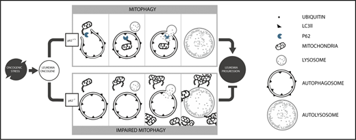 Figure 7. Model of p62-mediated mitophagy in AML development. Under oncogenic stress, p62 is required for (i) efficient removal of damaged mitochondria by mitophagy and (ii) rapid leukemia progression (upper). In the absence of p62, damaged mitochondria accumulate, leading to impaired mitochondrial function and reduced leukemia progression (lower).