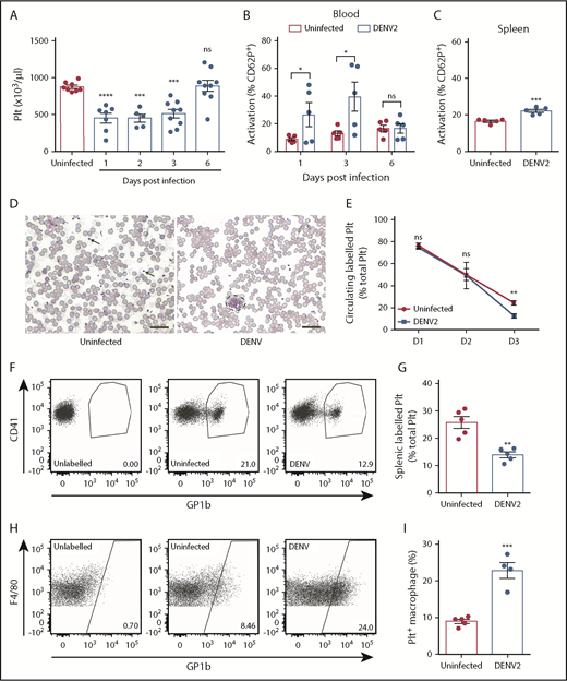 Figure 1. DENV infection results in thrombocytopenia because of increased platelet activation and uptake. (A) Platelet counts of C57Bl/6 mice infected with DENV2 (1 × 106 PFU via the intraperitoneal route; n = 5-9 per group). Blood and spleens of DENV2-infected mice were isolated, and cells were stained for platelet marker CD41 and activation marker CD62P and analyzed by flow cytometry (n = 5 per group). (B) There was increased activation of platelets in the blood at days 1 and 3 postinfection, with resolution at day 6. (C) Increased platelet activation in the spleen was observed 72 hours postinfection. Flow cytometry gating strategy is presented in supplemental Figure 2A. (D) Representative eosin and methylene blue staining of peripheral blood smears 24 hours postinfection. Some individual platelets are indicated by arrows. Platelet aggregates are surrounded by a dashed line. Scale bar, 25 μm. (E) Platelets were labeled in vivo to track their turnover by injecting mice with an antibody against platelet GP1b before DENV infection. Blood was taken at indicated points, stained for CD41, and analyzed by flow cytometry (n = 5 per group). Significantly reduced labeled platelets were observed in DENV-infected mice compared with uninfected control mice at 72 hours postinfection, indicating platelet destruction. (F) Representative flow cytometry plots of labeled circulating platelets 3 days postinfection. (G-I) Spleens were harvested from DENV2-infected mice 3 days postinfection; stained for CD41, CD11b, and F4/80; and analyzed by flow cytometry (n = 5 per group). (G) A significant reduction in total splenic labeled platelets was observed during DENV infection. (H) Representative flow diagram for macrophages containing platelets (CD11b+F4/80+GP1b+). Flow cytometry gating strategy is presented in supplemental Figure 2B. (I) Significantly increased numbers of macrophages had phagocytosed platelets (CD11b+F4/80+GP1b+) in spleens of DENV-infected mice compared with control, uninfected mice (n = 4-5 per group). Error bars represent the standard error of the mean. P values were determined by 1-way ANOVA for panel A, or by Student’s unpaired t test for all other panels, and error bars represent the standard error of the mean. ns, not significant; *P < .05; **P < .01; ***P < .001; ****P < .0001.