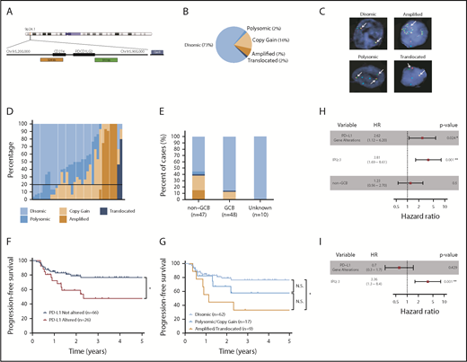 Figure 1. PD-L1 gene alterations are recurrently observed in DLBCL and are associated with inferior PFS to front-line chemoimmunotherapy. (A) Chromosome 9 structure. Enlarged below is the 9p24.1 region encoding PD-L1 and PD-L2. PD-L1, centromere 9, and translocation FISH probes are shown in orange, blue, and green respectively. (B) Incidence of PD-L1 alterations according to underlying mechanism. (C) Representative DLBCL cells with the indicated PD-L1 locus status as assessed by FISH. Arrows indicate signals for PD-L1 (orange) and translocation (green) probes. Split signals are seen between PD-L1 and translocation probes in the representative DLBCL with a PD-L1 translocation. (D) Waterfall plot demonstrating the frequency of lymphoma cells (30 analyzed/specimen) with the indicated PD-L1 locus status. The horizontal black line represents the minimum number of lymphoma cells required for a case to be considered PD-L1 altered (20% of cells). (E) Incidence of PD-L1 alterations by cell of origin (*P < .05, Fisher’s exact test). (F) PFS of DLBCL patients with or without PD-L1 gene alterations. (*P = .024, log-rank test). (G) PFS of DLBCL patients according to specific PD-L1 alteration (*P = .012, log-rank test). Clinical and genetic univariate (H) and multivariate (I) risk models for PFS in DLBCL.