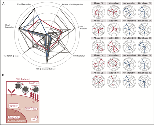 Figure 6. Graphical and schematic summaries of immune landscapes in DLBCLs with and without PD-L1 gene alterations. (A) Summary radar plot (left), with 20% radial intervals depicting 7 parameters that characterize the immunogenomic landscape of PD-L1 gene–altered vs unaltered subsets. Indices were normalized from 0 to 1; bold connecting lines represent average scores for PD-L1–altered (red) vs PD-L1–unaltered (blue) subsets. Curves for individual patients are represented as gray lines (left) or in individual radar plots (right), colored by PD-L1–altered (red) or PD-L1–unaltered (blue) status. (B) Schematic representation of the immunogenomic landscapes of PD-L1 altered DLBCLs. PD-L1 gene–altered DLBCLs are characterized by frequent loss-of-function mutations in TNFAIP3 (A20) and increased NF-κB pathway activation. As a result, these lymphomas demonstrate evidence of enhanced immune surveillance, including robust infiltration by clonally restricted T cells. In addition to marked upregulation of PD-L1 protein on the lymphoma cell surface, PD-L1 gene–altered DLBCLs also commonly downregulate HLA I and II expression and harbor loss-of-function mutations in other genes critical for maintaining tumor immune surveillance.