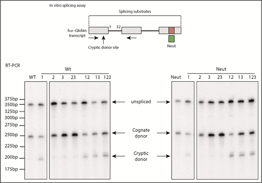 Figure 4. The splice regulatory function of the C-rich tract adjacent to the intron 1 splice donor is independent of the C-rich element within the 3′ UTR. The indicated set of intron 1 mutations (as in Figure 3) was assayed by in vitro splicing of a full-length WT hα-globin transcript with an intact 3′ UTR C-rich tract or with the C-rich tract substituted with a previously reported neutral (neut) sequence segment of the same size (green box).7,8 Products of the splicing reaction were assessed by RT-PCR using the indicated amplimer set (horizontal arrows). The increase in cryptic RNA (cryptic donor) and reciprocal decrease in normally spliced α-globin RNA (cognate donor) in all substrates containing mutation 1 (Mut 1) confirm the regulatory activity of the C-rich tract 3′ to the intron 1 splice donor (Mut 1) on splice donor utilization. The lack of a similar impact by Muts 2, 3, or 23 or Neut further demonstrated that this activity of the donor site splice regulatory element is independent of the C-rich elements at the intron 1 splice acceptor and within the 3′ UTR. The 25-bp ladder size marker is indicated on the left.