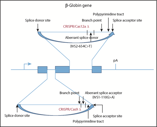 CRISPR/Cas deletion of aberrant splice sites provides a novel therapeutic approach for β-thalassemia. Two prevalent β-thalassemia mutations are illustrated in the human β-globin gene: IVS2-654C>T, which produces an aberrant splice donor site in IVS2, and IVS1-110G>A, which produces an aberrant splice acceptor site in IVS1. Additional sequences necessary for efficient splicing are also indicated. Xu et al demonstrate that electroporation of CD34+ HSPCs with ribonucleoproteins composed of Cas9 or Cas12a protein and guide RNAs complementary to the IVS1 or IVS2 mutations significantly increase the level of correctly spliced β-globin mRNA and, consequently, the amount of HbA produced in red blood cells after in vitro differentiation.