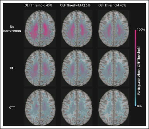 Figure 3. Percentage of patients with brain tissue experiencing increased metabolic stress decreases with HU. These population heat maps illustrate the percentage of participants within each white matter voxel that has an OEF exceeding the defined threshold overlaid on a T1 atlas (OEF threshold of 40%, left column; 42.5%, middle column; 45%, right column). The highest prevalence of elevated OEF consistently falls within the internal border zone in all 3 cohorts. The percentage of participants exceeding these thresholds is decreased in participants treated with HU compared with those not receiving disease-modifying therapy, but not to the extent of the participants receiving CTT.