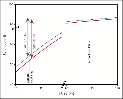 Plot of 2 hypothetical hemoglobin dissociation curves derived from the Hill equation and p50 values of 29.6 (solid line) and 28.6 (dotted line). The horizontal and vertical axes have been interrupted to highlight the small differences in oxygen saturation observed under both arterial and cerebral capillary pO2 values. OEF can be calculated as the difference in oxygen saturation under arterial oxygen conditions (pO2 95 mm Hg) and at the cerebrovascular capillary level (pO2 33 mm Hg). The left-shifted hemoglobin dissociation curve (dashed line) yields a lower OEF (41.4%) than the unshifted curve (OEF 43.3%), despite identical tissue pO2 levels. Thus, OEF, in isolation cannot be considered a marker of cerebrovascular risk.