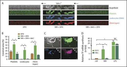 Figure 3. IdeS inhibits thrombus formation and TF synthesis induced by 5B9 and UFH. (A) Representative images corresponding to areas of 0.1 mm2 vWF-coated microfluidic channels perfused (5 minutes, 500 s−1; 20 dyn/cm2) with recalcified WB incubated for 30 minutes in the presence of UFH (0.5 IU/mL) without or with 5B9 alone (40 µg/mL) or 5B9 + IdeS (0.02 U/µg of IgG). In experiments with IdeS, WB containing 5B9 was preincubated with IdeS for 6 minutes at 37°C before the addition of UFH. Platelets are shown in green (DiOC6), fibrin(ogen) is in red (Alexa Fluor 647–labeled fibrinogen), and leukocytes are blue (Hoechst 33342, DNA dye). Experiments were performed with WB from 2 healthy donors. (B) Percentages of area covered by platelet/leukocyte aggregates and fibrin(ogen) after infusion of UFH, UFH + 5B9 without or with IdeS. (C) Representative microscopy images of a clot observed after perfusion (5 minutes, 500 s−1) with recalcified WB incubated for 30 minutes with 5B9 (40 µg/mL) and UFH (0.5 IU/mL). Platelets are shown in green (DiOC6), leukocytes are blue (Hoechst), and fibrin was visualized (purple staining) after adding a Cy3-labeled antifibrin specific monoclonal Ab (clone 59D8) (5 µg/mL). Images were acquired using a ORCA-R2 digital CCD camera with a 20× objective; scale bars, 20 µm. (D) Relative TF mRNA synthesis (mean ± SEM) after the addition of 5B9 (50 µg/mL) or LPS (1 µg/mL) to WB and incubated without or with IdeS (0.02 U/µg IgG; 6 minutes at 37°C) before the addition of UFH (0.5 IU/mL). *P < .05; NS, not significant.