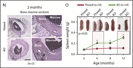 asrij KO mice develop a myeloproliferative disorder. (A) Flow cytometric detection of Asrij expression in LT-HSCs (LSK CD150+CD48−). Percentage of LT-HSCs positive for Asrij is detailed in the histogram overlay. Mean fluorescent intensity values for “FMO control” = 232 and “Asrij stained” = 506 (n = 3 wild-type mice). (B) HSCs (LSK CD150+) were immunostained with antibodies against Asrij (green), various endosome (Rab4, Rab5, Rab11), and mitochondrial (CoxIV) markers (red) and DAPI to mark nuclei (blue). Insets show magnified view of the boxed region. Graphs indicate extent of colocalization in a single confocal plane. Bar represents 2 µm (n = 30 cells from 3 wild-type mice). (C) Schematic showing strategy for generation of floxed allele of asrij at exon 6. Black rectangles, exons; blue triangles, loxP sites; light blue triangles, frt sites; lime green rectangles, neomycin cassette; 5′ probe and 3′ probe, probes for Southern blotting; black arrows, genotyping primers (Arj_F1, Arj_F2, and Arj_R1). (D-P) Floxed and KO cells were analyzed in all cases and are indicated in red and light green, respectively. (D) Graphs show change in PB cell counts (red blood cells, WBCs, and platelets) of floxed (red circles) and KO (green triangles) mice from 2 to 12 months of age. Statistically significant differences determined using repeated measures ANOVA are indicated (n = 10 mice per genotype). (E) Representative flow cytometry plots to show the frequency of Lin− cells, LKs, and LSKs at 6 months of age (n = 7 mice per genotype). (F) Graphs showing frequency of LKs and LSKs within BM and their absolute number per femur and tibia (n = 7 mice per genotype). (G) Flow cytometric analysis of the frequencies of LT-HSCs, ST-HSCs, and MPPs at 6 months of age, identified using SLAM markers CD150/CD48 (n = 7 mice per genotype). (H-I) Graphs showing frequency of LT-HSCs, ST-HSCs, MPP2, and MPP3 within LSK and their absolute number per femur and tibia (n = 7 mice per genotype). (J) Flow cytometric analysis of CMPs, GMPs, and MEPs at 6 months of age (n = 3 mice per genotype). (K-L) Graphs showing frequency of CMPs, GMPs, MEPs and common lymphoid progenitors within BM and their absolute number per femur and tibia (n = 3 mice per genotype). (M) Graph representing frequency of BM CD11b+ and CD19+ subpopulations at 6 months of age (n = 3 mice per genotype). (F,H,I,K,L,M) Statistically significant differences for determined using ANOVA: single factor analysis are indicated. (N) Hematoxylin and eosin staining of BM sections from 2-month-old mice. Right panels show magnified view of the boxed area. Arrow points to osteolytic lesions in KO bone (n = 3 mice per genotype). Bar represents 1 mm. (O) Graph showing change in spleen weight across different age groups. Representative spleen images are shown above the respective age groups. Bar represents 0.5 cm or 1 cm, as indicated (n > 7 mice per genotype). Bars denote standard error of mean. *P < .05, **P < .01, ***P < .001. LK, LIN−c-Kit+Sca-1−; LSK, LIN−c-Kit+Sca-1+.