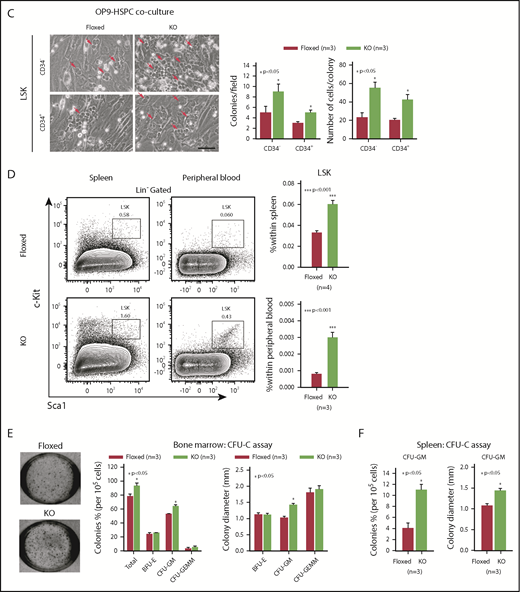 Asrij depletion significantly reduces quiescence and increases proliferation of HSCs. Floxed and KO cells were analyzed in all cases and are indicated in red and light green, respectively. (A) Representative Hoescht 33342/Pyronin-Y flow cytometric plots and graphs showing the cell-cycle distribution of HSPCs, LT-HSCs, ST-HSCs, and MPPs (n = 3 mice per genotype). (B) Cell proliferation analysis using Ki-67/7-AAD staining of HSPCs, LT-HSCs, ST-HSCs, and MPPs (n = 3 mice per genotype). (C) Representative images of OP9-HSPC cocultures showing colonies (red arrows) formed by HSPC (LSK-CD34− and LSK-CD34+) subpopulations. Bar represents 50 µm. Graphs quantify number of colonies formed and number of cells/colony (n = 3 mice per genotype). (D) Flow cytometric analysis and quantification of the HSPC frequencies in spleen and PB (n = 4 mice per genotype). CFU-C assay to test the differentiation potential of (E) BM cells and (F) splenocytes harvested from 6-mo-old mice under erythromyeloid promoting conditions (n = 3 mice per genotype). (E) Graphs show relative distribution of total, BFU-E, CFU-GM, and CFU-granulocyte/erythroid/macrophage/megakaryocyte colonies scored based on their morphology and colony diameter. (F) Graphs show colony percentage and colony diameter of CFU-GMs formed by splenocytes. Statistically significant differences identified using ANOVA: single factor analysis are indicated. Error bars denote standard error of mean. *P < .05 and **P < .01.