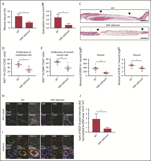 Figure 1. VWF-deficient mouse shows impaired wound healing and reduced angiogenesis. Full-thickness back-skin wounds were made in WT and VWF-deficient mice. After 5 days, (A) wound closure and (B) granulation tissue area were evaluated by histomorphometry. (WT, n = 6; VWF-deficient, n = 7). (C) Wound histology (hematoxylin and eosin staining). Black arrows indicate tips of the epithelium tongue. The granulation tissue (pink-violet) is characterized by infiltration of granulocytes with nuclei stained in dark-violet or black. Muscle under the wounds is stained in red; fat tissue appears as transparent bubbles. Scale bar = 800 µm. Proliferation of (D) CD31+CD45– ECs and (E) SMA+CD45– SMCs assessed by Ki67+ marker was determined using flow cytometry. The amounts of (F) VEGF-A and (G) FGF-2 in the wounds were quantified by enzyme-linked immunosorbent assay (ELISA). (H-I) Representative high-magnification image by immunofluorescence and (J) quantification of VEGF-A in mouse skin wound healing sections from WT and VWF-deficient mice; sections are costained for VWF (green), SMA (red), and CD31 (yellow) to visualize blood vessels; nuclei are identified by 4′,6-diamidino-2-phenylindole (DAPI) (blue). Scale bar = 10 μm. (J) Quantification represents the ratio between the sum of pixel intensity for VEGF-A signal and DAPI volume (μm3) (n = 2 fields per mouse; n = 5 mice per genotype). Graphical data are mean ± standard error of the mean (SEM), Statistical comparisons were carried out using the Mann-Whitney U test. AU, arbitrary unit. *P < .05; **P < .01.