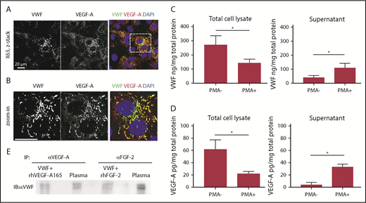 Figure 3. VWF and GF colocalize in ECs and interact in human plasma. (A) Representative high-magnification immunofluorescence images of VWF (green) and VEGF-A (red) expression in the wound, shown as single grayscale channels, in HUVECs; nuclei are identified by DAPI (blue). The white box identifies zoom area shown in (B). Scale bar = 20 μm. (C) VWF was quantified by ELISA in total HUVEC lysates (left) or in cell culture supernatants (right) in the presence or absence of phorbol myristate acetate (PMA) stimulation. Data expressed as ng/mg are normalized to total protein levels (mg) (n = 4; data are mean ± SEM). (D) VEGF-A was quantified by ELISA in total HUVEC lysates (left) or in cell culture supernatants (right) in the presence or absence of PMA stimulation. Data expressed as pg/mg are normalized to total protein levels (mg) (n = 4; data are mean ± SEM). (E) Human plasma or positive control (recombinant VWF + recombinant VEGF-A or FGF-2) was subjected to immunoprecipitation with anti-human VEGF-A antibody or anti-human FGF-2 antibody. Western blotting was performed with collected proteins using anti-human VWF antibody. Mann-Whitney U test was used for analysis. *P < .05.