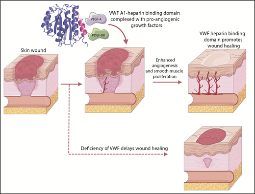 VWF promotes growth factor recruitment and wound healing. The HBD of VWF-A1 binds to proangiogenic growth factors, including VEGF-A and PDGF-BB. This interaction promotes sequestration and slow release of growth factors at sites of wound healing to enhance angiogenesis and smooth muscle proliferation, and ultimately, to accelerate tissue repair. Conversely, VWF deficiency results in reduced levels of growth factors at the wound site and delayed wound healing.