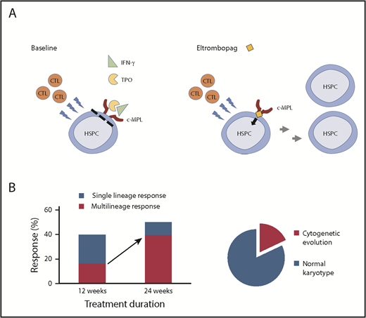 (A) In acquired aplastic anemia, cytotoxic T lymphocytes (CTLs) attack HSPCs, leading to bone marrow aplasia. Elevated levels of inflammatory cytokines cause further bone marrow suppression, in part by interferon-γ (IFN-γ)–mediated inhibition of the endogenous thrombopoietin (TPO) signaling through the c-MPL receptor. A small molecule thrombopoietin mimetic eltrombopag is not affected by IFN-γ and can stimulate c-MPL signaling leading to HSPC recovery. (B) Extending the course of eltrombopag therapy from 12 to 24 weeks in patients with rSAA increased hematologic responses from 40% to 50% and nearly doubled the rate of multilineage hematologic responses. Eighteen percent of rSAA patients treated with eltrombopag developed chromosomal abnormalities within the 24-week study period.