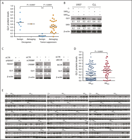 Figure 3. Relationship between GLI1 expression and Hh-pathway mutations. (A) GLI1 protein expression in CLL cells with missense mutations (n = 39) deduced as being benign or damaging according to PolyPhen-2. The horizontal bar in each group provides the mean level of GLI1 protein expression observed for each group. The Mann-Whitney U test was used to calculate the P value indicated at the top. (B) Immunoblot analyses of CLL cells and the U937 cell line transfected with empty vector (C–), wild-type SMO (SMOWT), or mutant SMO carrying P26S, which is a non-inactivating missense mutation (SMOMU), as indicated at the top. The membranes were probed with a monoclonal antibody mAb specific for GLI1, SMO, or β-actin as indicated on the left margin. The expression of β-actin was used to normalize GLI1 and SMO expression. The ratios of the band densities are provided at the bottom of each blot. (C) Immunoblot analyses for proteins indicated on the right using lysates of CLL cells that were treated with control siRNA (siCTR) or tumor suppressor–specific (siFBXW7 or siCREBBP or siBCOR) siRNA as indicated. (D) Densitometry analysis of immunoblot in panel E quantifying GLI1 protein expression levels for CLL sample with leukemia cells with or without Hh-pathway mutations (HhMU, n = 49; HhWT, n = 161). The horizontal bar in each group provides the mean level of GLI1 protein expression observed for each group. The Mann-Whitney U test was used to calculate the P value indicated at the top. (E) Immunoblot analyses of CLL cells with or without Hh-pathway mutations (HhMU), as indicated at the top. Each lane represents a separate case. The membranes were probed with a monoclonal antibody specific for GLI1 or β-actin, as indicated on the left margin. The density of the β-actin band was used to normalize band density for GLI1 in each sample. The ratios of the band densities of GLI1/β-actin for each sample are indicated at the bottom and presented in the dot-plots in panel D. The same protein lysate from JeKo-1 cells was used as a positive control (C+) in all gels. GLI1+ CLL samples were defined as those with ratios of the band densities of GLI1/β-actin >0.1.
