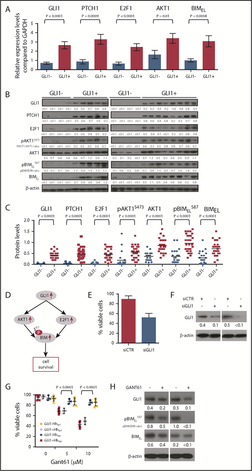 Figure 4. Relationship between GLI1 expression and GLI1 downstream targets. (A) GLI1, PTCH1, E2F1, AKT1, and BIM transcript levels in CLL cells expressing or lacking GLI1 (GLI1+, n = 28; GLI1–, n = 21). The Mann-Whitney U test was used to calculate the P value indicated at the top. (B) Representative immunoblot analyses of CLL cells with or without GLI1 expression (GLI1+, n = 28; GLI1–, n = 21), as indicated at the top. Each lane represents a separate case. The membranes were probed with a monoclonal antibody specific for GLI1, PTCH1, E2F1, AKT1, pBIM, and BIM or β-actin as indicated on the left margin. The expression of β-actin was used to normalized GLI1, PTCH1, E2F1, AKT1, and BIM expression levels. The ratios of the band densities for each case are provided at the bottom of each blot and presented in the dot-plots in panel C. The ratios of the band densities for each case of pBIMELS87/BIMEL is indicated at the bottom of the pBIMELS87 blot and represented in the dot-plots in panel C. The same GLI1+ CLL protein lysate sample was used as positive control in all gels. (C) Densitometry analysis quantifying the protein expression levels of GLI1 and its downstream targets in all 49 cases with CLL cells with or without GLI1 expression. The horizontal bar provides the mean ratio observed in each group. The Mann-Whitney U test was used to calculate the P value indicated at the top. (D) Schematic representation of the consequences of GLI1 upregulation on its downstream targets. (E) Relative viability of CLL cells treated with control siRNA (siCTR) or GLI1-specific siRNA (siGLI1) as indicated. (F) Immunoblot analyses for GLI1 using lysates of CLL cells expressing GLI1 treated with siCTR or siGLI1. Data from 2 representative patients are presented. (G) Relative viability of CLL cells expressing GLI1 with (GLI1+ HhMU, n = 6; red squares) or without (GLI1+ HhWT N = 3, gray squares) Hh mutations or lacking GLI1 expression with (GLI1– HhMU, n = 3; blue circles) or without (GLI1– HhWT, n = 6; yellow circles) Hh mutations treated for 24 hours with 5 or 10 μM of GANT61. Data are shown as mean ± standard deviation. (H) Immunoblot analyses of CLL cells expressing GLI1 and treated for 24 hours with 10 μM of GANT61. The membranes were probed with a monoclonal antibody specific for GLI1, pBIM, and BIM or β-actin as indicated on the left margin. The expression of β-actin was used to normalized GLI1 and BIM expression level. The ratios of the band densities for each case are provided at the bottom of each blot. The ratios of the band densities for each case of pBIMELS87/BIMEL are indicated at the bottom of the pBIMELS87 blot. Data from 2 representative patients are presented.